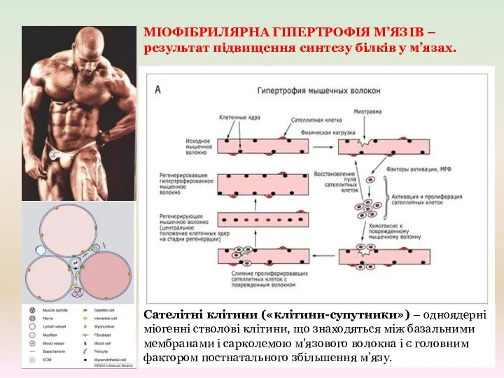 МІОФІБРИЛЯРНА ГІПЕРТРОФІЯ М’ЯЗІВ – результат підвищення синтезу білків у м’язах.