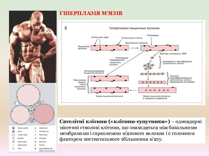 ГІПЕРПЛАЗІЯ М’ЯЗІВ Сателітні клітини («клітини-супутники») – одноядерні міогенні стволові клітини,