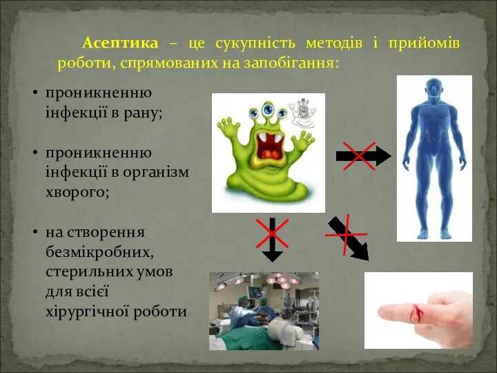 Асептика – це сукупність методів і прийомів роботи, спрямованих на