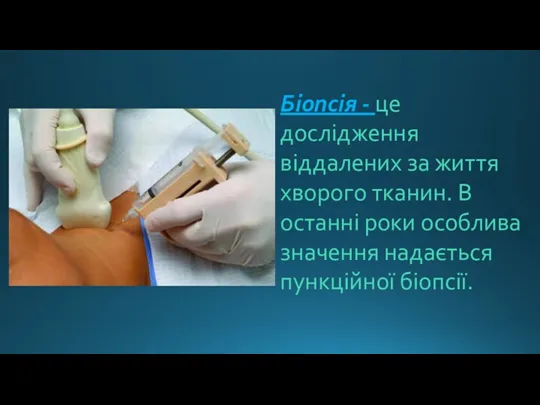 Біопсія - це дослідження віддалених за життя хворого тканин. В