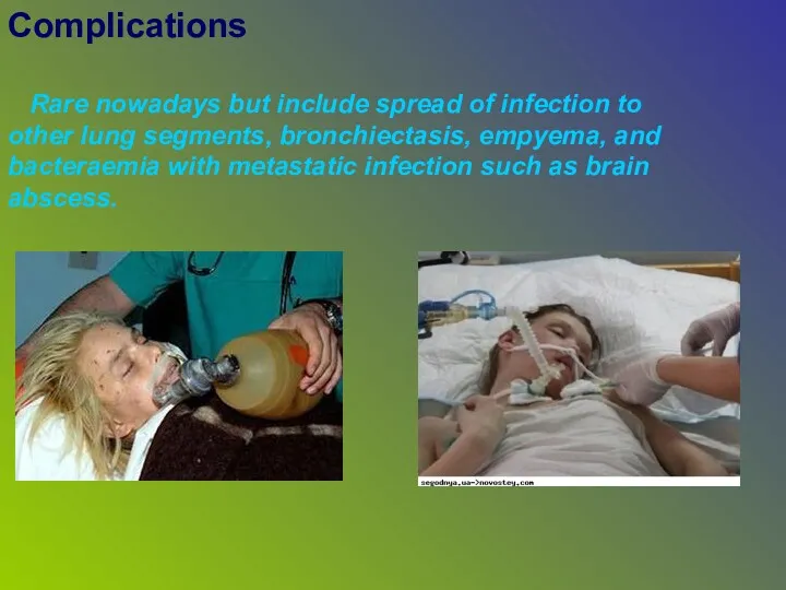 Complications Rare nowadays but include spread of infection to other lung segments, bronchiectasis,