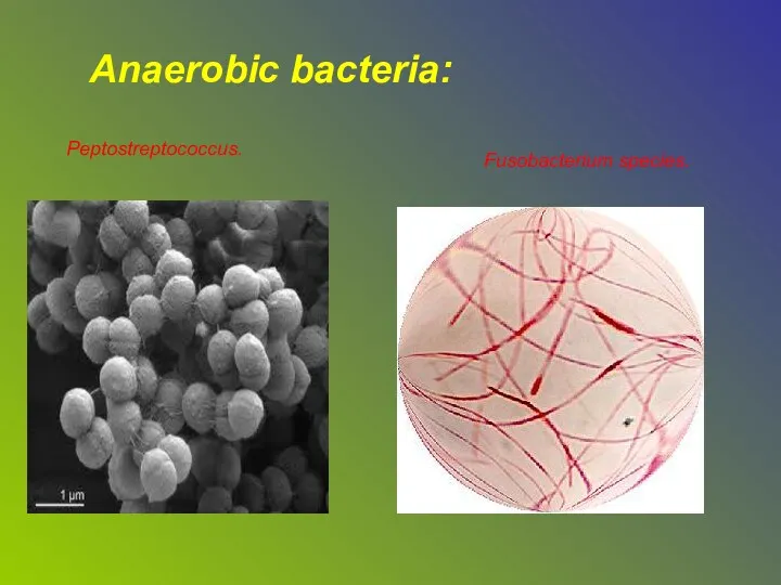 Anaerobic bacteria: Peptostreptococcus. Fusobacterium species.