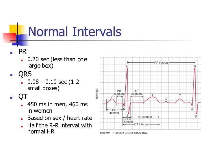 Normal Intervals PR 0.20 sec (less than one large box) QRS 0.08 –