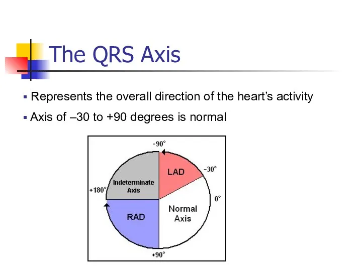 The QRS Axis Represents the overall direction of the heart’s activity Axis of