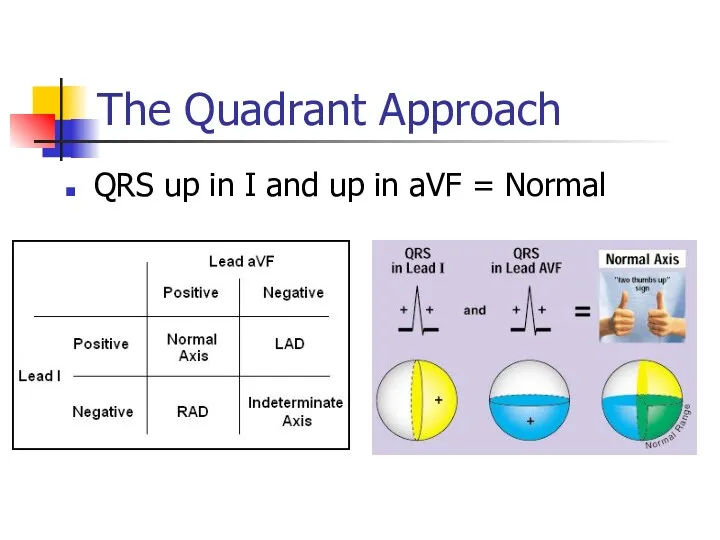 The Quadrant Approach QRS up in I and up in aVF = Normal
