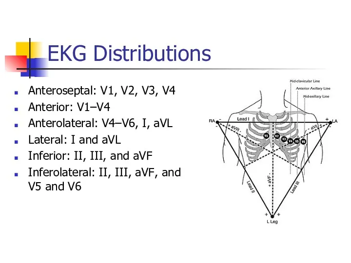 EKG Distributions Anteroseptal: V1, V2, V3, V4 Anterior: V1–V4 Anterolateral: V4–V6, I, aVL