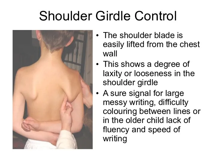 Shoulder Girdle Control The shoulder blade is easily lifted from