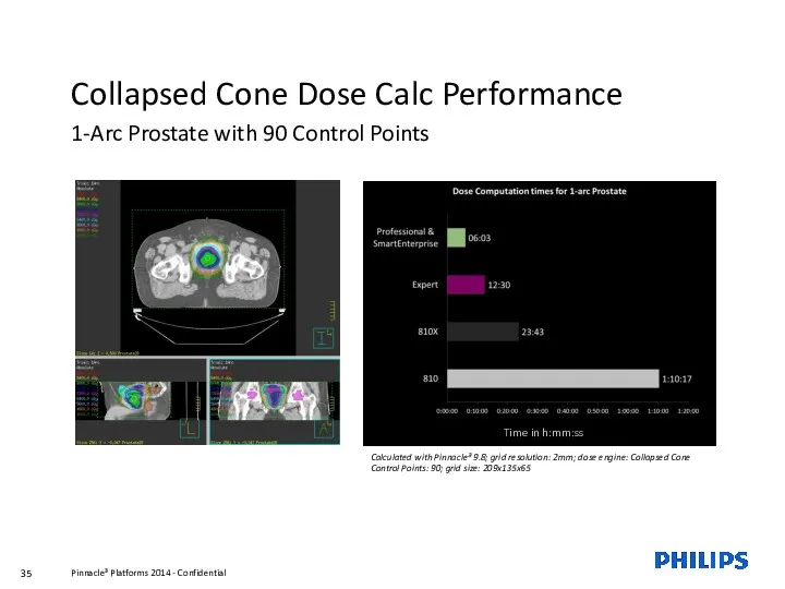 Collapsed Cone Dose Calc Performance 1-Arc Prostate with 90 Control