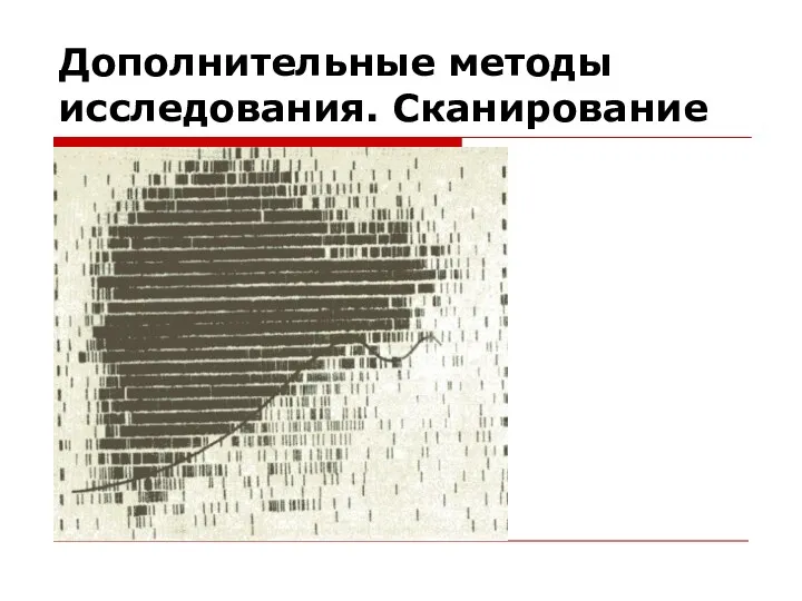 Дополнительные методы исследования. Сканирование