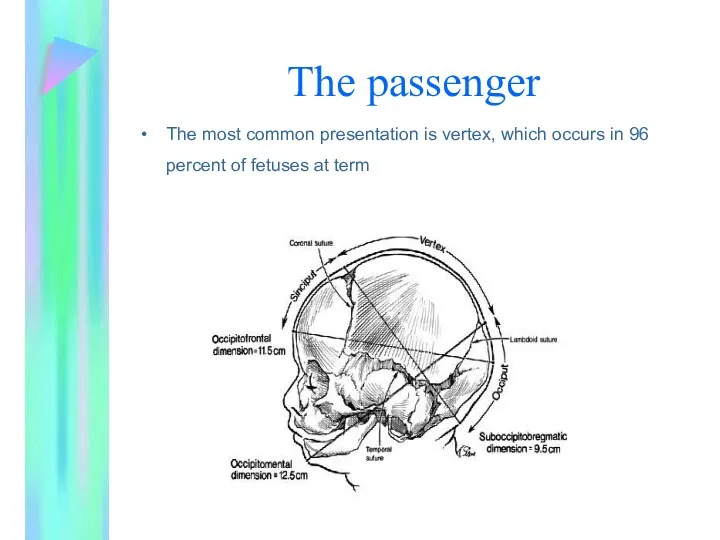 The passenger The most common presentation is vertex, which occurs