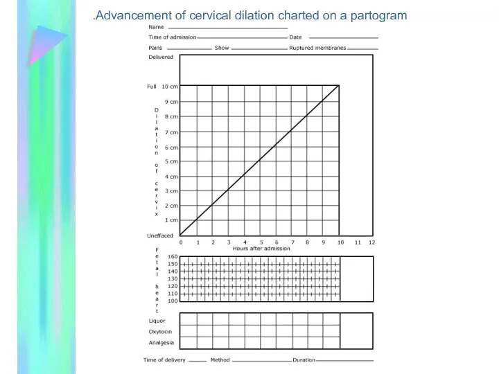 Advancement of cervical dilation charted on a partogram.