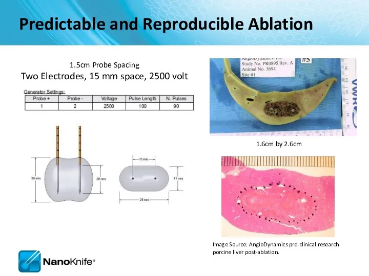 1.6cm by 2.6cm 1.5cm Probe Spacing Two Electrodes, 15 mm