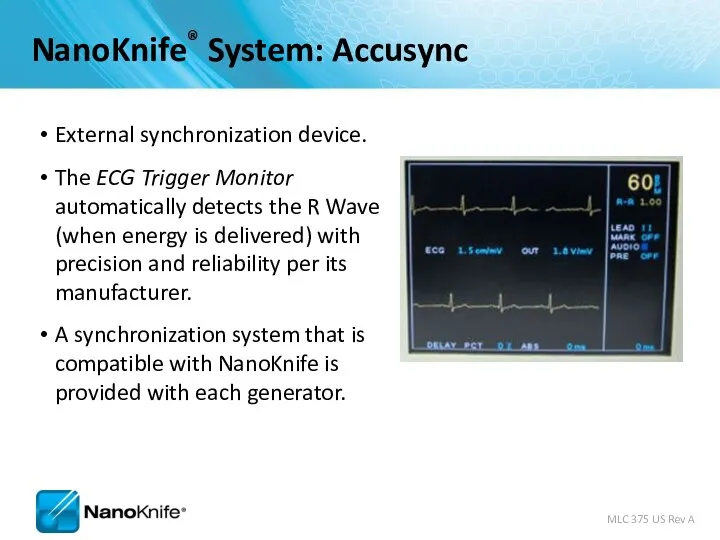 External synchronization device. The ECG Trigger Monitor automatically detects the