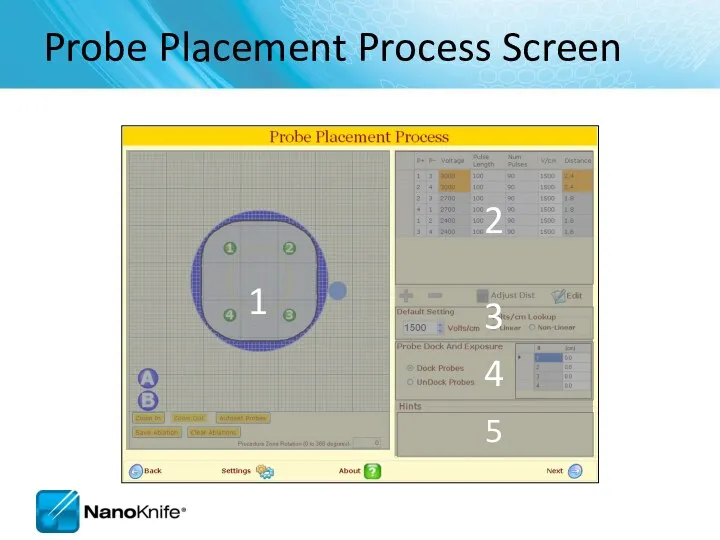 Probe Placement Process Screen 1 2 3 4 5