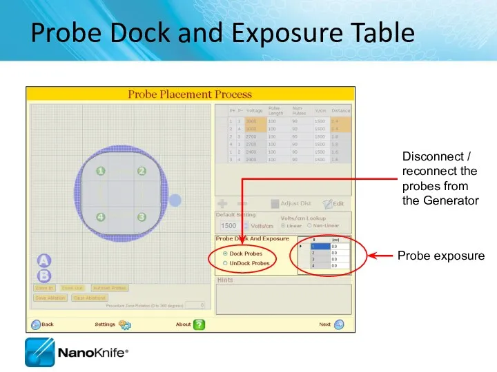 Probe Dock and Exposure Table Disconnect / reconnect the probes from the Generator