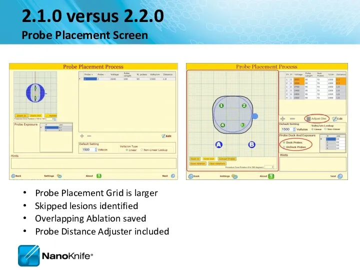 2.1.0 versus 2.2.0 Probe Placement Screen Probe Placement Grid is