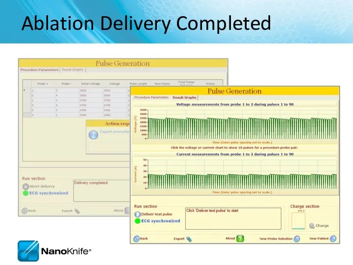 Ablation Delivery Completed