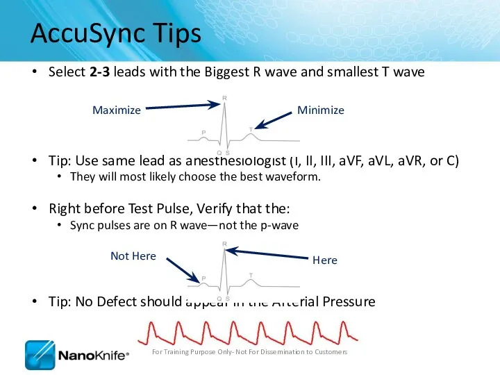 Select 2-3 leads with the Biggest R wave and smallest