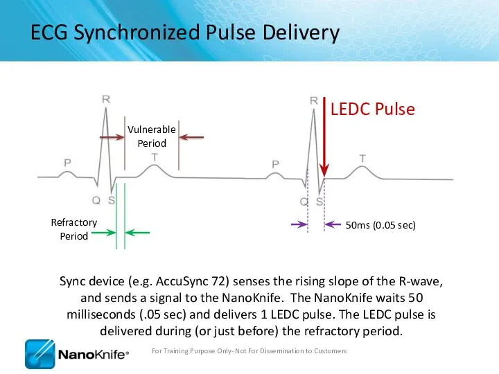 ECG Synchronized Pulse Delivery Sync device (e.g. AccuSync 72) senses