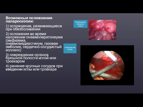 Возможные осложнения лапароскопии: 1) осложнения, развивающиеся при обезболивании 2) осложения