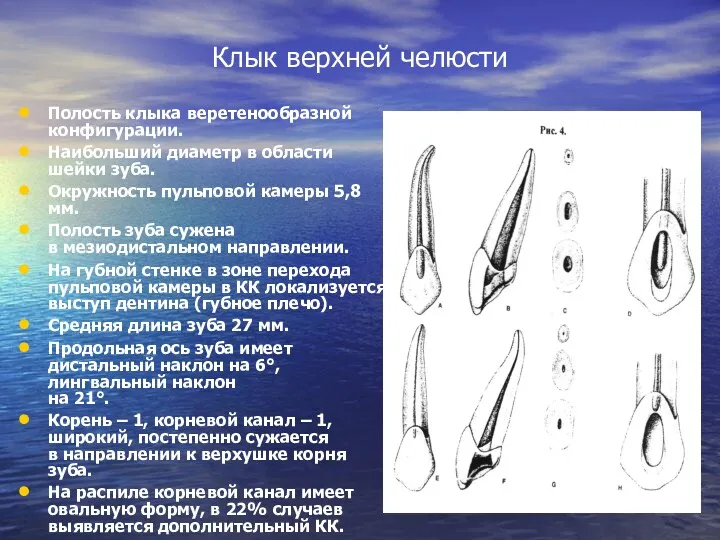 Клык верхней челюсти Полость клыка веретенообразной конфигурации. Наибольший диаметр в области шейки зуба.