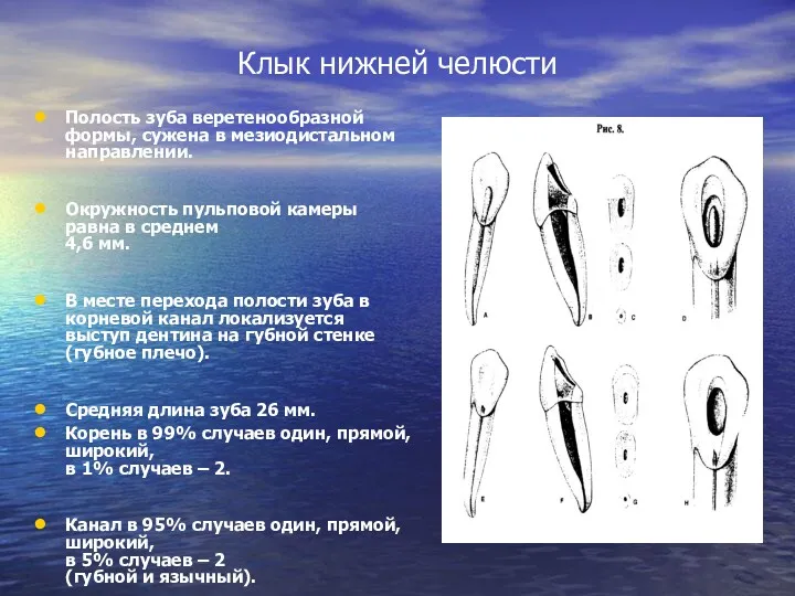 Клык нижней челюсти Полость зуба веретенообразной формы, сужена в мезиодистальном направлении. Окружность пульповой