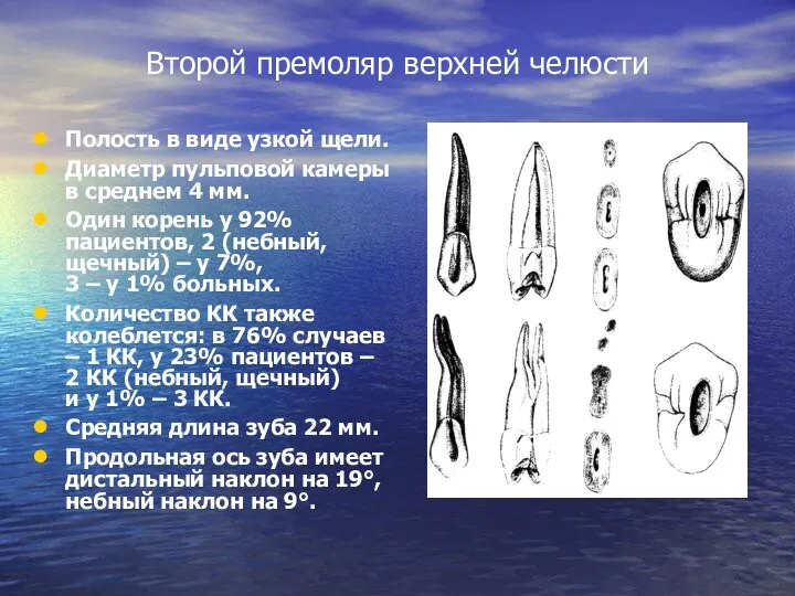 Второй премоляр верхней челюсти Полость в виде узкой щели. Диаметр пульповой камеры в