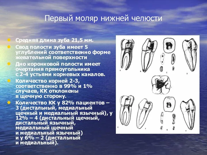 Первый моляр нижней челюсти Средняя длина зуба 21,5 мм. Свод полости зуба имеет