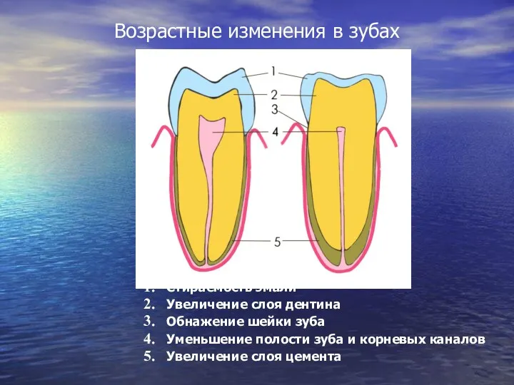 Возрастные изменения в зубах Стираемость эмали Увеличение слоя дентина Обнажение шейки зуба Уменьшение