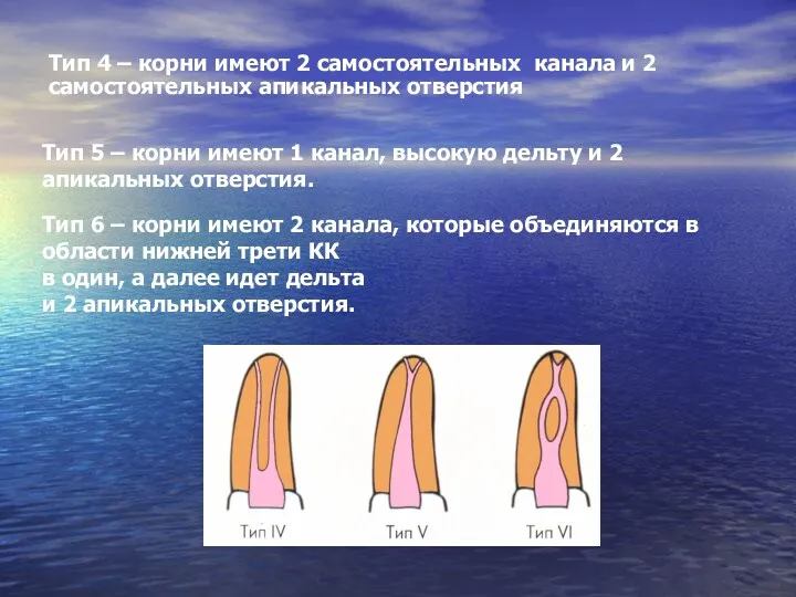 Тип 4 – корни имеют 2 самостоятельных канала и 2 самостоятельных апикальных отверстия