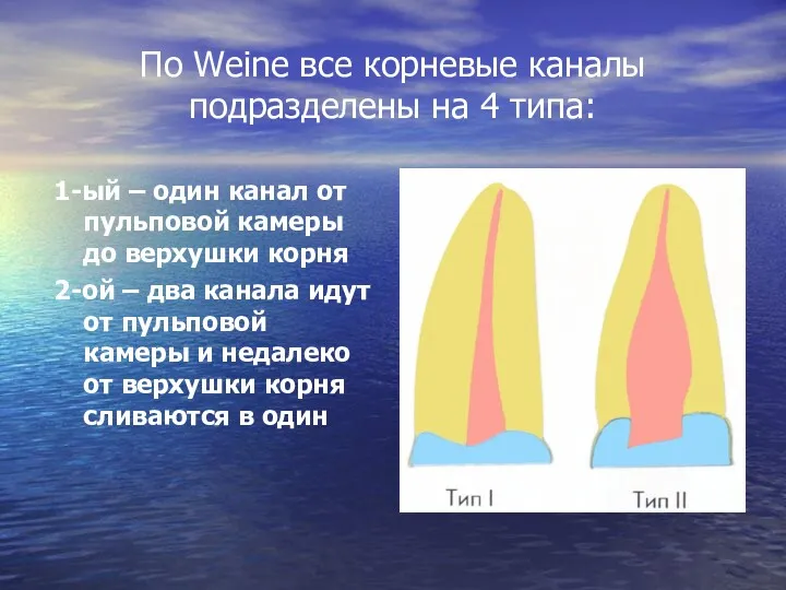 По Weine все корневые каналы подразделены на 4 типа: 1-ый – один канал