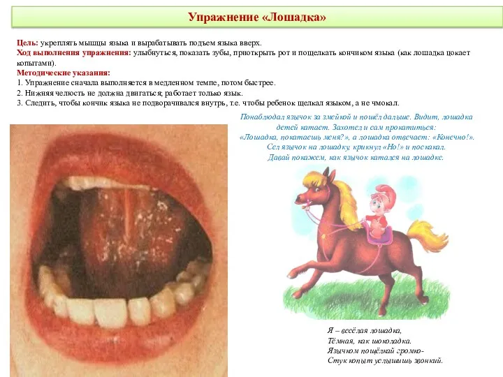 Упражнение «Лошадка» Цель: укреплять мышцы языка и вырабатывать подъем языка