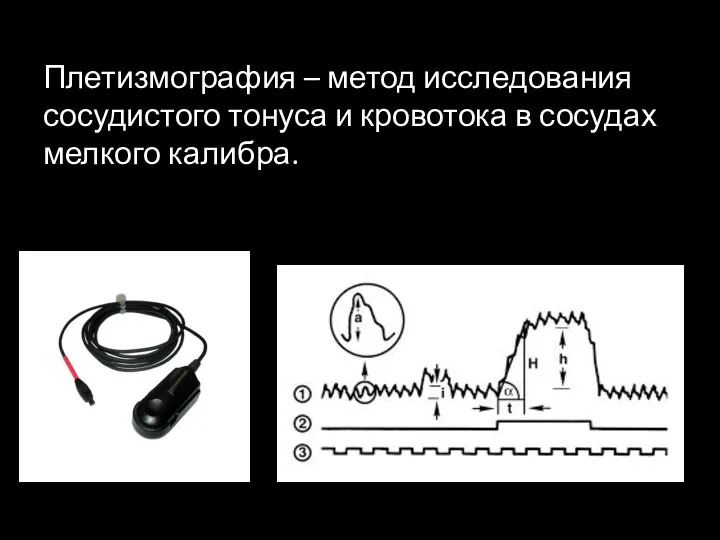 Плетизмография – метод исследования сосудистого тонуса и кровотока в сосудах мелкого калибра.