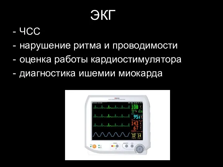 ЭКГ ЧСС нарушение ритма и проводимости оценка работы кардиостимулятора диагностика ишемии миокарда
