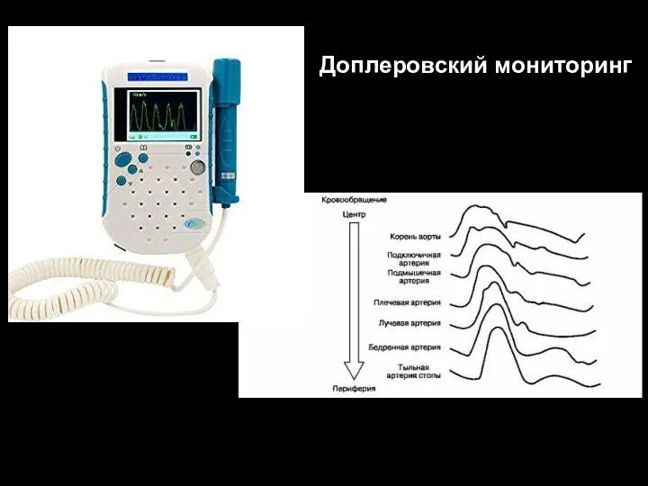 Доплеровский мониторинг