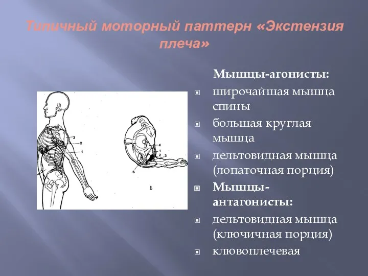 Типичный моторный паттерн «Экстензия плеча» Мышцы-агонисты: широчайшая мышца спины большая