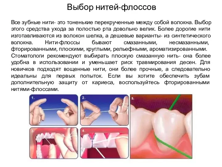 Выбор нитей-флоссов Все зубные нити- это тоненькие перекрученные между собой