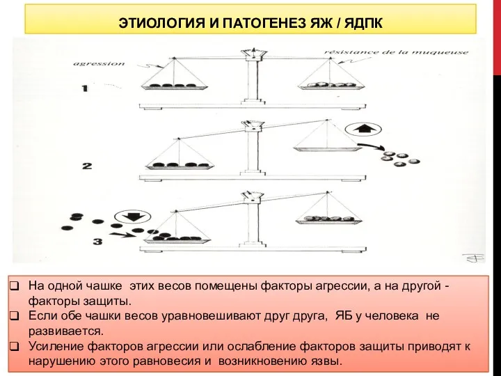 ЭТИОЛОГИЯ И ПАТОГЕНЕЗ ЯЖ / ЯДПК На одной чашке этих