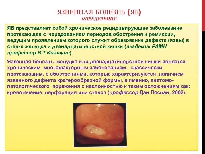 ЯЗВЕННАЯ БОЛЕЗНЬ (ЯБ) ОПРЕДЕЛЕНИЕ ЯБ представляет собой хроническое рецидивирующее заболевание,