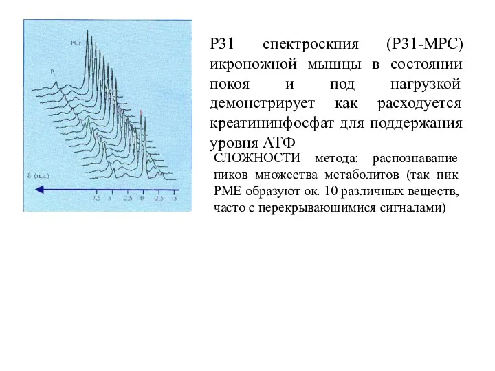 Р31 спектроскпия (Р31-МРС) икроножной мышцы в состоянии покоя и под