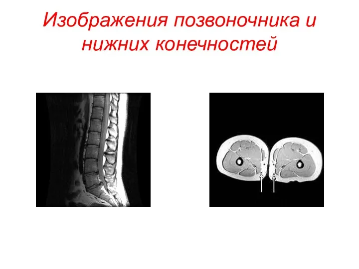 Изображения позвоночника и нижних конечностей