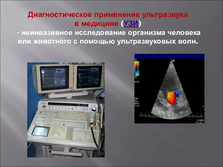 Диагностическое применение ультразвука в медицине (УЗИ) - неинвазивное исследование организма