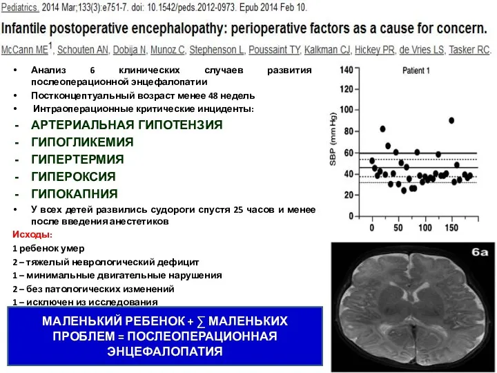 Анализ 6 клинических случаев развития послеоперационной энцефалопатии Постконцептуальный возраст менее