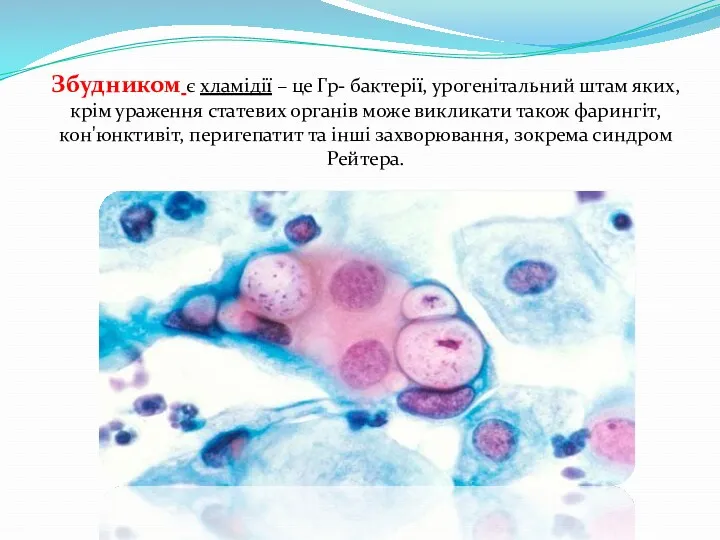Збудником є хламідії – це Гр- бактерії, урогенітальний штам яких,