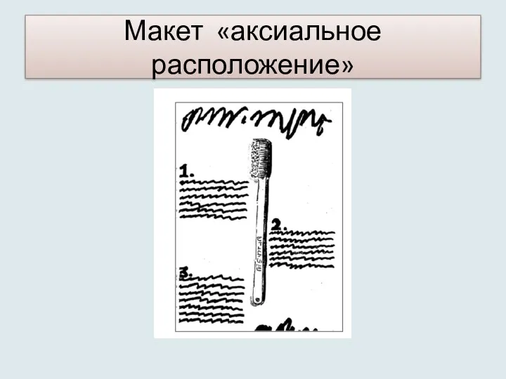 Макет «аксиальное расположение»