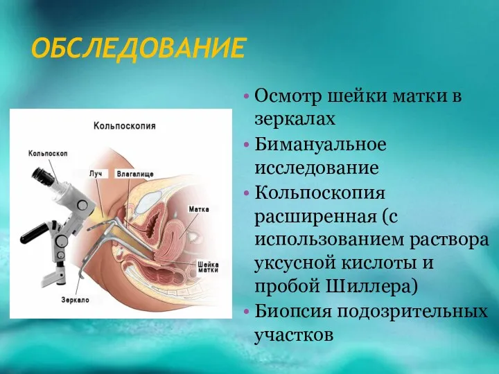 ОБСЛЕДОВАНИЕ Осмотр шейки матки в зеркалах Бимануальное исследование Кольпоскопия расширенная