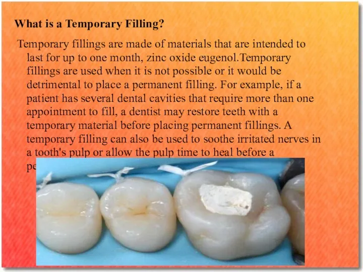 What is a Temporary Filling? Temporary fillings are made of