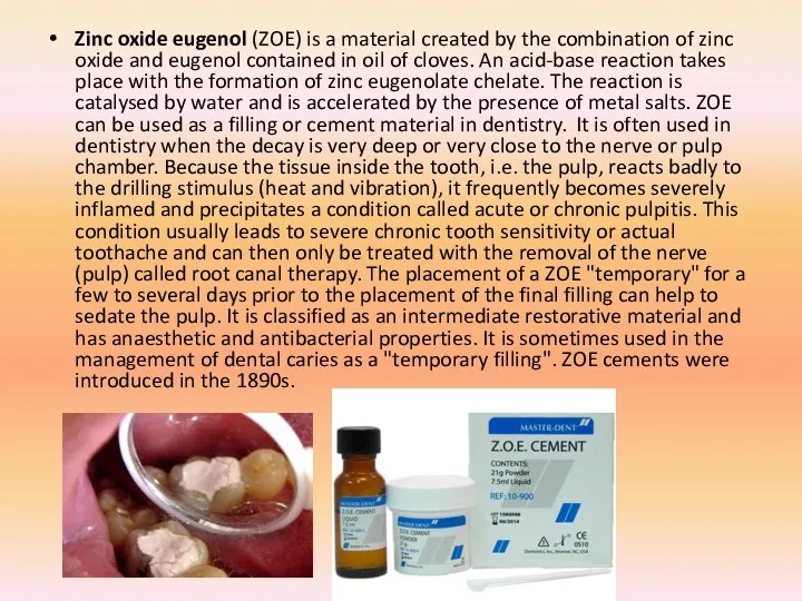 Zinc oxide eugenol (ZOE) is a material created by the combination of zinc