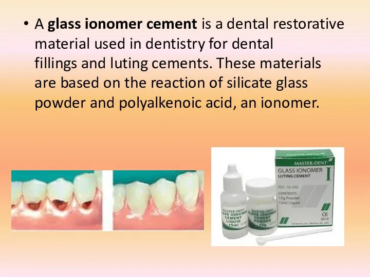 A glass ionomer cement is a dental restorative material used in dentistry for