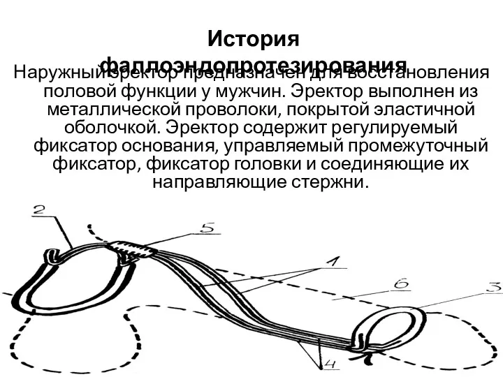 Наружный эректор предназначен для восстановления половой функции у мужчин. Эректор